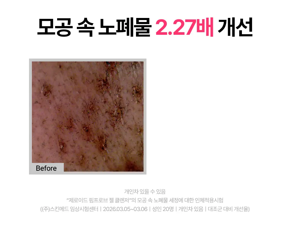 [트러블 피부 추천/여드름균 항균 클렌징] 제로이드 핌프로브 젤 클렌저 180ml 상세페이지 22